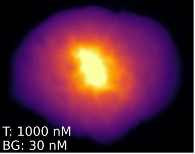 Fluorescent image of breast lumpectomy phantom